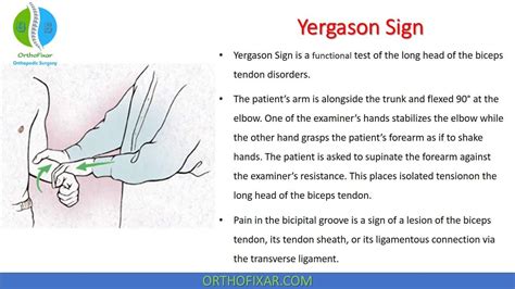 transverse humeral ligament tear test|speed test and yergason's sign.